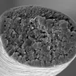 0CFA5F6A-F16C-42C1-A80D-42458C4F85EA Normaler Schnitt